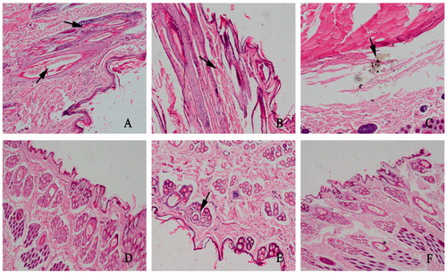 Figure 7. Pathological paraffin sections from local injection site of rabbits after injection on the Days 4 and 14 (magnification, ×100). (A), (B) and (C) Skin samples from rabbits given the commercially available IVM injection. (A) Small amount of inflammatory cell infiltration was shown at the injection site on the fourth day. (B), (C) Until 14th day, severer inflammation and hemorrhage appeared and crystals were also observed. (D), (E) Skin samples from rabbits administered IVM-SPC-SDC-MMs on fourth and 14th days, respectively. (F) Skin sample from rabbits given sodium chloride injection. The phenomenon shown in (A), (B) and (C) were not observed in (D), (E) or (F).
