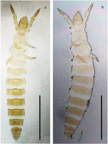 Figure 2. Acerentulus panamensis sp. nov. (interference contrast microscope) (a) holotype; (b) paratype.