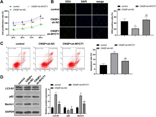 Figure 5. CNQP stimulates KGN cell apoptosis and autophagy via GATA3/MYCT1. KGN cells were transfected with sh-NC or sh-MYCT1 and cultured with CNQP-containing serum: CCK-8 (A) and EdU (B) were used to detect cell proliferation; (C) flow cytometry to detect cell apoptosis; and (D) western blotting to detect autophagy-related protein expression. N = 3; **p < .01, compared to the control group; #p < .05 and ##p < .01, compared to the CNQP + sh-NC group.