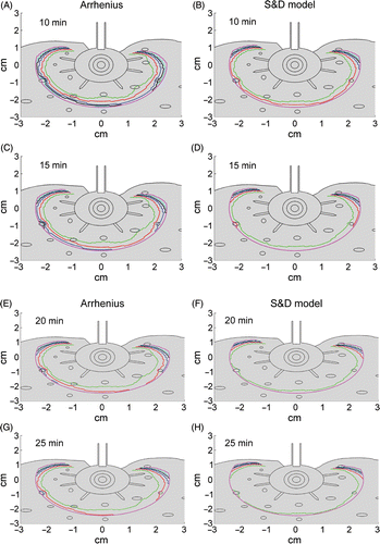 Figure 5. Calculated perimeters of the ablated zones due to CITT ablation at maximum probe temperature range of 90 to150°C for 10, 15, 20 and 25 minutes ablation. The Arrhenius model was used in Figures 5A, C, E and G; the S&D model was used in Figures 5B, D, F and H.