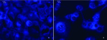 Figure 3. Fluorescence microscopy of subcellular distribution of copolymer 2, applied at a concentration of 0.1 mg/mL, in (A) BALB/c 3T3 cells and (B) Ehrlich ascites carcinoma cells, after 24 h of treatment.