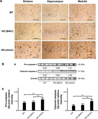 Figure 9 Expressions of apoptosis-related caspase 3 in the brain tissue of R6/2 (HD) mice were reduced under oral B401 treatment.