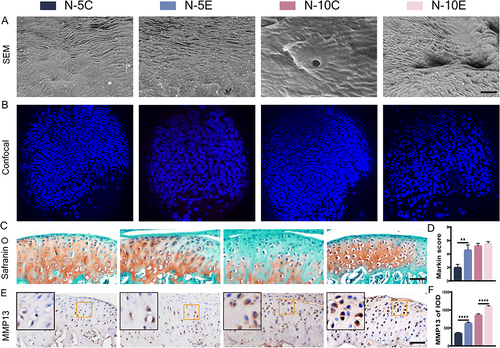 Figure 2 MCC degeneration of Nrf2-/- mouse and Nrf2+/+ mouse condyles under overloading force. (A) SEM of condylar cartilage surface, bar=150 μm; (B) laser confocal microscopy of Nrf2-/- mouse and Nrf2+/+ mouse condyles; (C and D) S&O staining and Markin score of condyles under overloading force, bar=50 μm; (E and F) immunohistochemical staining and IOD value statistics of MMP13, bar=50 μm. The orange boxed area in the images is magnified in the upper left corner. n= 5, **P<0.01, ****P<0.0001 indicate significant differences between groups.