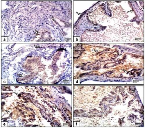 Figure 10. Photomicrographs of formalin-fixed oviduct immunohistochemical stain with ki-67, (a) negative control, (b and c) PVP-capped AuNRs positive control, (d and e) DMBA carcinogenesis, (f) DMBA carcinogenesis treated with PVP-capped AuNRs. Note overexpression in immunostaining of ki-67 in DMBA carcinogenesis and amended in PVP-capped AuNRs -treated studied group. The degree of ki-67 immunoreactivity is shown by the arrowheads. The magnification power used 400 × .