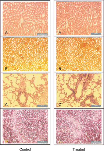 Figure 1.  Histological examination: liver (A), kidney (B), lungs (C), and spleen (D).