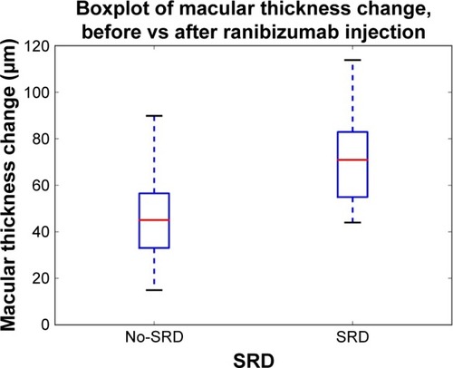 Figure 1 First month macular thickness changes of the groups with serous retinal detachment (SRD) and without SRD after single-dose intravitreal ranibizumab injection.