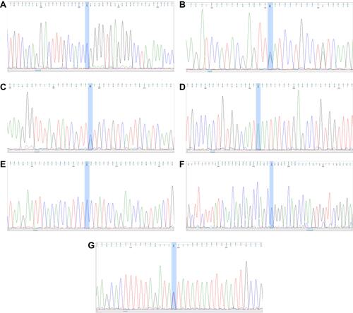 Figure 2 PCR-sequencing of (A) rs2237892 C > T, (B) rs1470579 C > A, (C) rs10946398 C > A, (D) rs8050136 A>C, (E) rs10830963 C > G, (F) rs13266634 C > T and (G) rs7903146 T > C. The highlighted blue area marks the polymorphisms.
