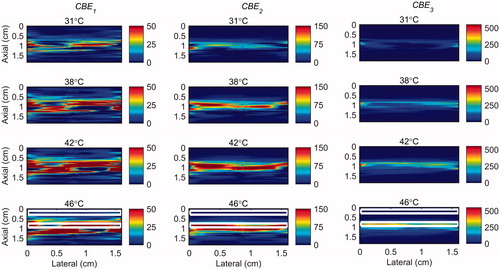 Figure 4. 2 D maps of CBE1 (left), CBE2 (middle), and CBE3 (right) in tissue mimicking gel phantom while the temperature was cooling down from 46 °C to 26 °C and no vibration was present in the phantom. The temperatures measured by the inserted thermocouple were 31, 38, 42 and 46 °C at the center of heated region. The color bars represent percentage change in backscattered energy. The horizontal rectangles are the regions of interest for calculating the CNR and SNR.