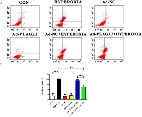 Figure 5. Flow cytometry detects apoptosis in AECII cells. (A) Upregulation of PLAGL2 can alleviate hyperoxia-induced apoptosis in AECII cells. (B)Quantitative analysis of apoptotic cell percentages. Percentage of cell apoptosis = Q2 (early apoptosis) + Q4 (late apoptosis). *p < 0. 05, **p < 0. 01, ***p < 0. 001 was considered statistically significant.