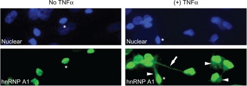 Figure 4 Heterogeneous nuclear ribonucleoprotein (hnRNP) A1 localization following TNF-α exposure in neurons. Without TNF-α exposure, hnRNP A1 is localized to nuclei (*) in dNT-2 neurons (left panels) (blue nuclear stain is diamidino-2-phenylindole; green stain is immunohistochemistry using an anti-hnRNP A1 antibody). Following exposure to TNF-α (400 ng/mL, 50 mM glutamate, 30 minutes), hnRNP A1 is also found in the cytoplasm (arrowheads) and neuronal processes (arrow) of neurons (lower right panel).