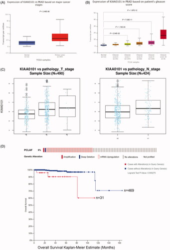 Figure 6. Expression profiles and clinical significance of PCLAF in prostate cancer samples. (A) Up-regulated PCLAF mRNA expressions in TCGA primary prostate cancer samples uncovered by UALCAN, p = 2.49e-06. (B) PCLAF expressions correlated with clinical characteristics of Gleason score 7, 8, 9, 10, p = 2.04e-02, 1.15e-04, 7.03e-11, 1.97e-12. (C) Positive correlation between the expression of PCLAF and the T-stage (left) or N-stage (right) in TCGA-PRAD revealed by LinkedOmics, p = 5.51e-08, 2.66e-03. (D) cBioPortal Kaplan-Meier survival analysis for PCLAF with or without alterations on 500 prostate cancer patients with death outcome, p = 2.75e-04.