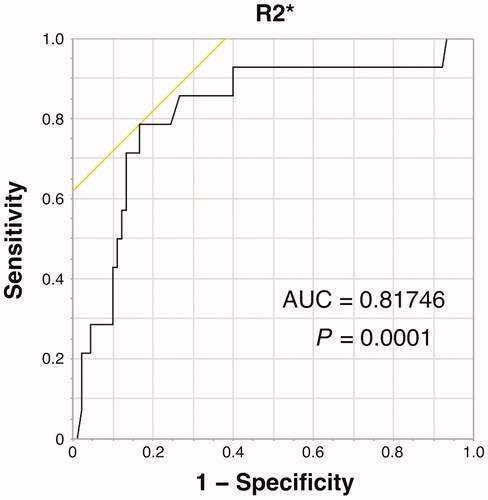 Figure 3. AUC of R2* for distinguishing BMD-T score ≤ −2.5 and > −2.5 was estimated to be 0.817, with cut-off values of 50.7 s−1. AUC: area under the curve; BMD: bone mineral density.