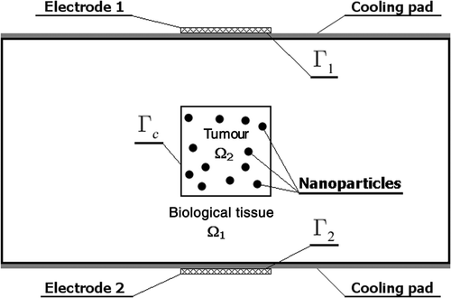 Figure 1. Hyperthermia system.