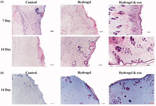 Figure 7. Histological analysis of the wounds in different experimental conditions. (A) H&E staining microscopic images of healing wound sites. (B) MT staining of collagens in wound sites. Scale bar: 100 μm.