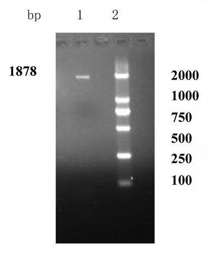 Figure 1. Agarose gel electrophoresis of PCR product. Lane 1: PCR product of HSP70; Lane 2: DNA marker (DL2000). The whole BCG HSP70 gene was amplified by using PCR and an approximate 1880bp fragment was consistent with Mycobacterium tuberculosis HSP70 gene released by GeneBank.