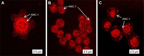 Figure 8 Confocal microscopy observations of ANC-1 uptake on SKBR3 (A), MDA-MB-453 (B) and MDA-MB-231 (C) cells, after 6 hour exposition.Note: Magnification ×40.Abbreviation: ANC, antibody nanoconjugate.