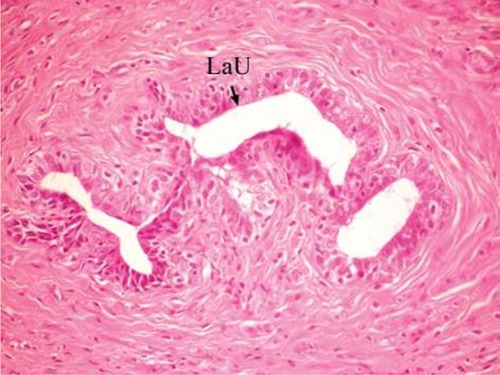 Figure 3 Photomicrograph of breast section of normal control rat showing normal LaU (H and E, ×400).