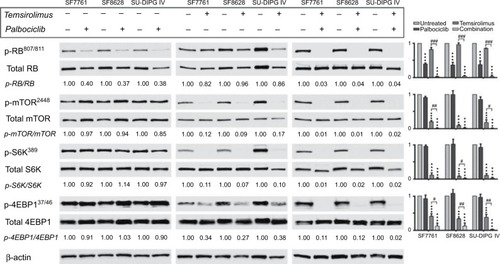 Figure 1 CDK4/6 and mTOR inhibitors cross-regulate, leading to enhanced inhibition of the respective pathways when used in combination.Notes: SF7761, SF8628, and SU-DIPG IV cells were treated with vehicle, 0.5 µM palbociclib, 10 µM temsirolimus, or coadministered 0.5 µM palbociclib with 10 µM temsirolimus for 24 hours prior to total protein extraction and immunoblot analyses. Quantitative densitometry values are shown below each blot. Densitometry graphs compare single-agent treatments and combination treatment to vehicle-treated controls (right). β-actin was used as a loading control. Data are the mean ± SEM of triplicate determinations in all instances. *p < 0.05; **p < 0.01; ***p < 0.001 (compared to respective vehicle treatment). #p < 0.05; ##p < 0.01; ###p < 0.001 (compared to respective temsirolimus single-agent treatment).Abbreviations: RB, retinoblastoma protein; CDK, cyclin-dependent kinase; mTOR, mechanistic target of rapamycin protein; S6K, p70 ribosomal protein S6 kinase; 4EBP1, eukaryotic translation initiation factor 4E-binding protein 1; rictor, rapamycin-insensitive companion of mammalian target of rapamycin; p-, phosphorylated form of protein.