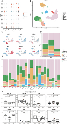 Figure 2 ScRNA-seq analysis. (A) Characteristic markers for all cells. (B) UMAP plots for all cells. (C) Projection of significant markers on UMAP plots. (D) Bar graph showing the proportion of major cell lineages in each group. (E) bar graph showing the proportion of significant cell lineages in each patient. (F) Proportion of cells between groups. A one-sided unpaired Wilcoxon test was used to calculate p-values. The center line indicates the median value, and the upper and lower hinge lines indicate the 75th and 25th percentiles, respectively.