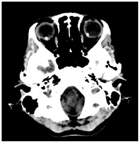 Figure 4 Computed tomography.