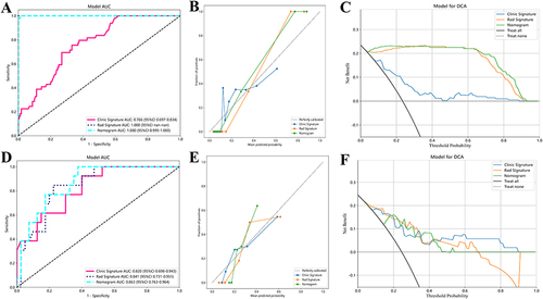 Figure 4 The ROC curve, calibration curve, and DCA curve of three models in evaluating HCC differentiation in the training (A–C) and validation (D–F) cohorts, respectively. The radiomics model presented higher diagnostic accuracy, better goodness-of-fit and improved net clinical benefits in the training cohort.