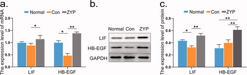 Figure 7. The mRNA and protein expression levels of LIF and HB-EGF at the second oestrous cycle. (*p < 0.05, **p < 0.01) (a) The mRNA expression levels of LIF and HB-EGF in rat endometrium. (b) The representative images of western blot for LIF and HB-EGF in rat endometrium. (c) Comparison of the protein expression levels of LIF and HB-EGF in rat endometrium. Con: control; ZYP: Zishen Yutai Pill; LIF: leukaemia inhibitory factor; HB-EGF: heparin-binding epidermal growth factor.