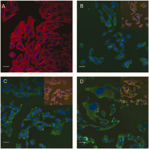 Figure 7. Confocal images of CHo cells treated with different ptx concentrations for 12 h. (A) Negative control; (B) ptx at 50 ng/ml; (C) ptx at 100 ng/ ml; D: ptx at 200 ng/ml, to exhibit the effect of ptx concentration on toxin translocation (ptx at 20 ng/ml). Green fluorescence represents ptx, blue fluorescence represents nucleus, and red fluorescence represents F-actin of cytoskeleton. Scale bar = 20 μm. Reproduced with kind permission from Taylor and Francis [Citation54].