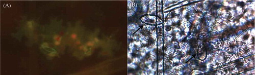Fig. 4 (Colour online) Auto-fluorescence of cells expressing the hypersensitive response to Phytophthora infestans following the trypan blue clearing method. (A) Hypersensitive response observed as auto-fluorescence of the cells was mostly associated with the presence of sporangia and/or mycelia when detected through bright field microscopy. (B) Arrows indicate sporangia present near the affected cells. Strain 4084, originally isolated from P. peruviana, is shown on this figure.