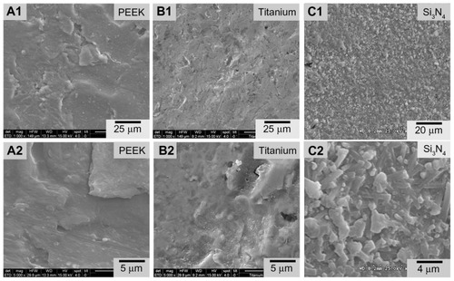 Figure 1 Scanning electron microscopy surface microstructures of PEEK Optima®, Ti, and Si3N4: (A1) PEEK 1000×; (A2) PEEK 5000×; (B1) Ti 1000×; (B2) Ti 5000×; (C1) Si3N4 1000×; (C2) Si3N4 5000×.Abbreviation: PEEK, poly-ether-ether-ketone.