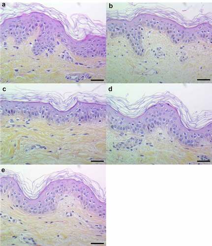 Figure 6. Histopathology of 3D control and stimulated human skin explants. Skin sections of explants were stained with Hematein-Eosin-Safran (HES) at 10 min (a) and 24 h post-incubation without (b) or with supernatants containing all PSMs (c), supernatants from PSMα1-4-deficient strain (d) and supernatants from total PSM-deficient strain (e) deposited on a paper disk on the top of explants for 24 h. Scale bar = 20 µm
