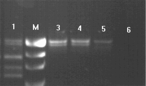 Figure 2.  Electrophoresis of the PCR products of SRY+ chromosomes. Line 1, positive control (male); line 2, marker (R322DNA/BsuRI); line 3, SRY and ZFX/Y amplification of case I; line 4, SRY and ZFX/Y amplification of case II; line 5, female control; line 6, negative control.