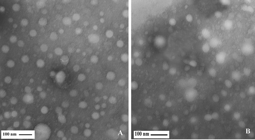 Figure 1 Transmission electron micrographs of casein micelles from milk with 200,000 < SCC cells/ml. Bar: 100 nm (A, B).
