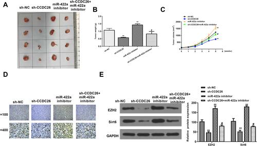 Figure 6 CCDC26 contributes to tumor growth of thyroid cancer via miR-422a/EZH2/Sirt6 axis in vivo. (A–E) The effect of CCDC26/miR-422a/EZH2/Sirt6 axis on tumor growth of thyroid cancer cells in vivo analyzed by nude mice tumorigenicity assay. SW579 cells were treated with control shRNA (sh-NC), CCDC26 shRNA (sh-CCDC26), miR-422a inhibitor, or co-treated with CCDC26 shRNA (sh-CCDC26) and miR-422a inhibitor and injected into the nude mice (n=4). (A) Representative images of dissected tumors from nude mice. (B) Average tumor weight. (C) Average tumor volume. (D) Ki-67 expression level in tumor tissues measured by immunohistochemical staining. (E) The protein expression levels of EZH2, Sirt6, and GAPDH in tumor tissues examined by Western blot analysis. The results of Western blot analysis were quantified by ImageJ software. Data are presented as mean ± SD. Statistic significant differences were indicated: **P < 0.01, #P < 0.05.