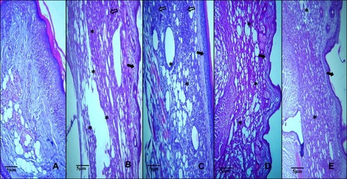 Figure 17 Microphotographs of histopathological paw sections of CIA mice at 40x magnification. (A) Healthy control mice with normal synovium and bone morphology. (B) Arthritic model mice showed hyperplasia of synovial lining (black arrow), bone erosion (*), and cellular infiltration (hollow arrow). (C) Leflunomide treated CIA mice showed cellular infiltration with restored normal bone morphology. (D) 5 mg/kg SeNPs treated mice. (E) 10 mg/kg SeNPs treated mice. SeNPs treatment led to relief of cellular infiltration and synovial hyperplasia along with restoration of normal bone morphology.