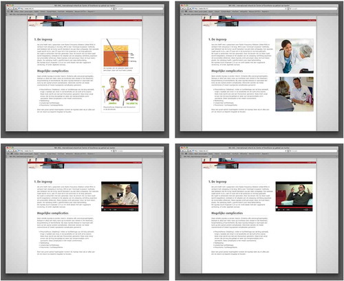 Fig. 2. Webpages containing RFA treatment information presented in text and medical illustrations (top left), text and non-medical illustrations (top right), text and a video with a doctor (bottom left), and text and a video with a patient (bottom right). Webpage with text-only information is not displayed, since it is equal to the webpages shown in this figure without the illustrations or videos.