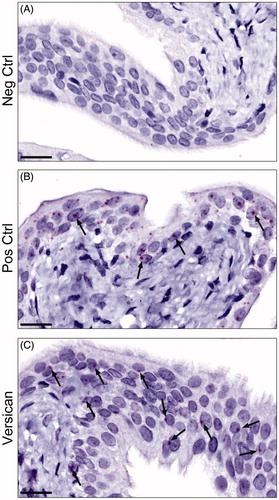 Figure 2. Representative images of the mRNA expression of versican in rat urinary bladder visualized using RNAscope® technology. (A) The urinary bladder was stained with DapB as a negative control. As expected no staining was seen. (B) Staining instead with polR2A as a positive control, generated a clear-cut positive reaction in the urothelial cells (arrows) and to a markedly lower extent in the remaining parts of the bladder. (C) The urinary bladder was stained for versican. Sparse, albeit clear, positive staining (arrows) was found in the urothelium, but also in scattered cells throughout the lamina propria, and the muscle cells (not shown in figure). Scale bar: 20 µm.