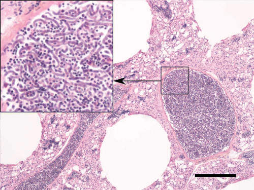 Figure 1.  Extremely high microfilarial burden in the lung vessels of an emaciated boreal owl. Scale bar = 200 µm; haematoxylin phloxine saffron. Insert: numerous intertwined microfilariae have completely filled the vascular lumen.