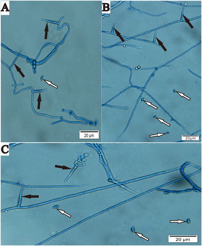 Figure 2. Conidiogenous cells and conidia of Epichloë endophyte isolated from Hordeum brevisubulatum after incubation on PDA at 22°C. A, Conidia (white arrow) and conidiogenous cells (black arrow) of WBE1; B, Conidia (white arrow) and conidiogenous cells (black arrow) of WBE3; C, Conidia (white arrow) and conidiogenous cells (black arrow) of WBE4. Bar = 20 μm.