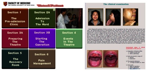 Figure 6 Index page (left) and typical web page (right) from the perioperative virtual patient.