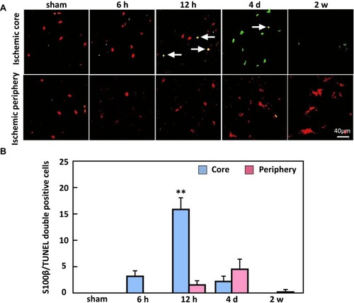 Figure 8 Double immunofluorescence staining of S100β and TUNEL. (A) Representative images indicate S100β and TUNEL double-positive cells, and (B) the density of double-positive cells significantly increased by 4 d post-ischemia in the core region of the cortex. Arrows show that double-positive cells. Bar scale=40 µm. **P < 0.01, compared to sham.