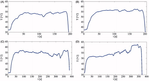 Figure 4. Temperature trend during LA in the common bile duct (A) and the cystic duct (B) at 7 W for 3 min, and in the common bile duct (C) and the cystic duct (D) at 7 W for 6 min.