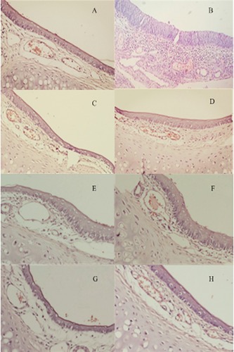 Figure 10 Nasal mucosa of rats treated with (A) normal saline (B) 1% deoxycholic acid sodium solution (C, E, G) HupA-NE on days 1, 7, 14 (D, F, H) Lf-HupA-NE on days 1, 7.14.