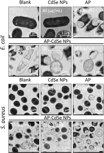 Figure 7 TEM images of MDR E. coli and MDR S. aureus. Cell treated with AP-CdSe NPs solutions at various concentrations (10, 20, 40 µg/mL). Bacterial culture treated with AP solution (40 µg/mL) and CdSe NPs solution (40 µg/mL) were used as control groups. The PBS-treated group was used as the blank group.