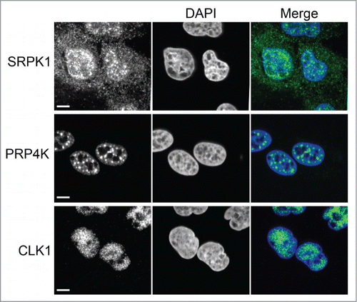 Figure 2. Splicing kinase cellular localization. Human osteosarcoma U2OS cells were analyzed by immunofluorescence confocal microscopy using an anti-SRPK1, anti-PRP4K or anti-CLK antibody (green). Nuclei were stained with DAPI (blue). Scale bar = 5 microns.