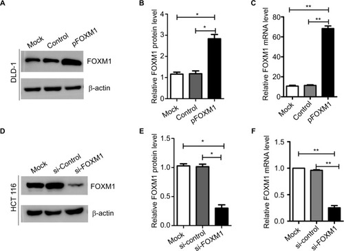 Figure 2 Expression of FOXM1 protein and mRNA in colon cancer cells after transfection with pFOXM1 or si-FOXM1.Notes: (A) DLD-1 cells were transfected with either untransfected (mock), pcDNA3.1 (control), or pFOXM1 plasmids. Western blots demonstrated that FOXM1 protein levels were significantly increased after transfection with pFOXM1. (B) The relative protein folds in DLD-1 after transfection with pFOXM1, *P<0.05. (C) Relative FOXM1 mRNA expression levels of DLD-1 cells were upregulated markedly after transfection with pFOXM1, **P<0.01. (D) HCT116 cells were transfected with either untransfected (mock), FOXM1 si-control, or si-FOXM1. Western blots demonstrated that FOXM1 protein levels were significantly reduced after transfection with si-FOXM1. (E) The relative protein folds in HCT116 after transfection with si-FOXM1. (F) Relative FOXM1 mRNA expression levels of HCT116 cells were decreased after transfection with FOXM1 siRNA which were quantified by real-time PCR (**P<0.01). β-actin was evaluated as an internal control. Data are presented as mean ± SD for at least three independent experiments. Statistical analysis was done using Student’s t-tests.Abbreviations: pFOXM1, pcDNA3.1-FOXM1; si-control, control-siRNA; si-FOXM1, FOXM1 siRNA.