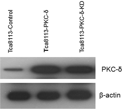 Figure 6. Tca8113 cells were transfected with the control, wild-type PKC-δ, and PKC-δ-KD plasmids for 24 h, respectively. Western blotting showed comparable expression of PLS3 in Tca8113- PLS3 cells and Tca8113-PLS3 (T21A) cells.