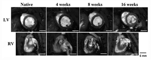 Figure 3. C-ECM patched hearts showed no geometric changes in the RV and LV when compared with native hearts that had not undergone surgery. The LV of reconstructed hearts maintains its native circular shape, indicating minimal pressure changes within the RV after patch implantation. Scale indicates 6 mm.