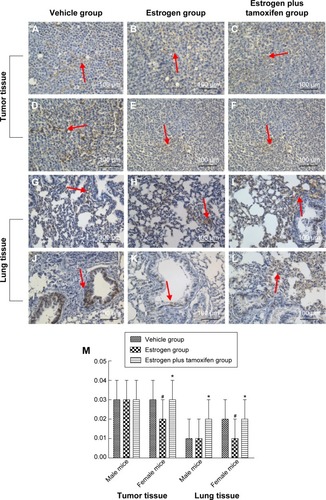 Figure 10 Protein immunohistochemical results of E-cadherin in mice tumor tissue and lung tissue; 400× magnification.