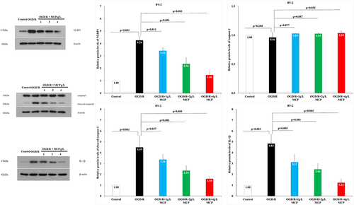Figure 8 The effects of MCP on NLRP3 inflammasome, cleaved-caspase-1/caspase-1, and IL-1β in microglial cells (BV-2) after OGD/R injury. Western blot analysis showed that MCP treatment reduced the expression of NLRP3 inflammasome, cleaved-caspase-1, and IL-1β in BV-2 cells after OGD/R operation. Proteins had been normalized to β-actin. OGD/R indicates oxygen-glucose deprivation/reperfusion; MCP, modified citrus pectin, NLRP3, NOD-like receptor 3. Data are mean ± standard deviation, and n=5 per group.