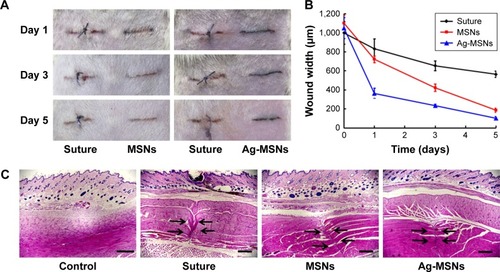 Figure 5 In vivo wound healing performance of nano-adhesives.Notes: (A) Representative macroscopic images of the wound healing treated by ethicon suture or nano-adhesives (MSNs and Ag-MSNs) in a Wistar rat model for 5 days. (B) Measurement of the width between the borders of the wound area after 5 days. The values represent the mean values±SD, n=6. (C) H&E staining images of normal skin treated with ethicon suture, MSNs and Ag-MSNs at day 5 post-wounding. The scale bars represent 500 µm. The arrows indicate the wound edges.Abbreviations: Ag-MSNs, nanosilver-decorated mesoporous silica nanoparticles; MSNs, mesoporous silica nanoparticles.